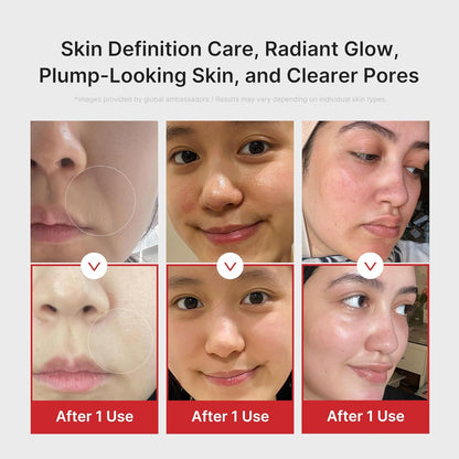 medicube Age-R Booster Pro Pink | 6-in-1 Real Glass Glow Beauty Massager | Looking Glass Skin | Korean Skin Care